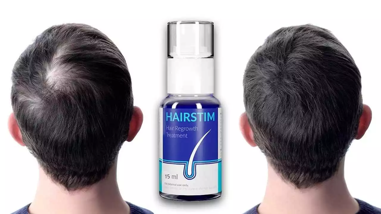 Hairstim recenzii: cum funcționează produsul pentru regenerarea părului?