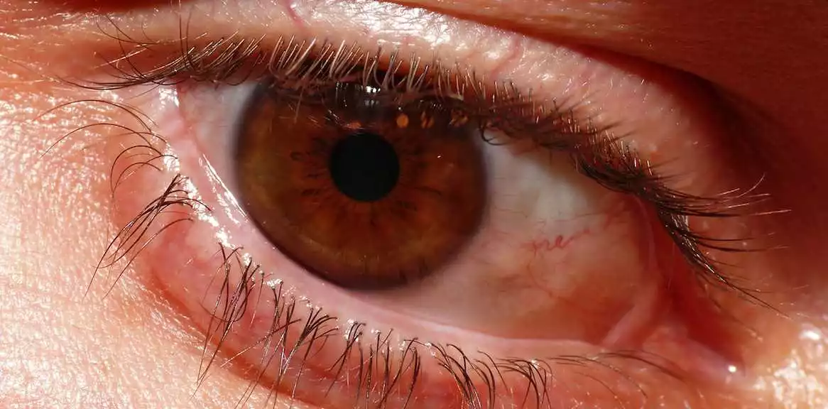 De Ce Este Important Să Ai Grijă De Sănătatea Ochilor Tăi